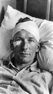 Simo Häyhä recovering from his wound in a hospital bed, with a bandaged face but a calm and resolute expression.